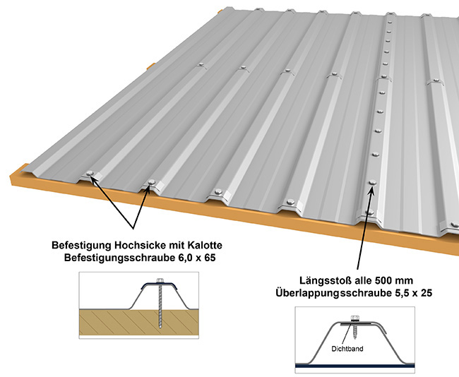 hochsickenbefestigung-m20kd-210