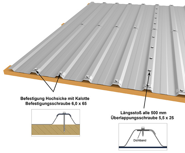 Hochsickenbefestigung m20/210